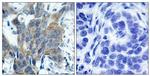 Phospho-beta Catenin (Ser33) Polyclonal Antibody