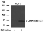 Phospho-beta Catenin (Ser33) Antibody in Western Blot (WB)