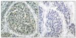 Phospho-beta Catenin (Ser37) Antibody in Immunohistochemistry (Paraffin) (IHC (P))