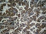 Phospho-beta Catenin (Tyr333) Antibody in Immunohistochemistry (Paraffin) (IHC (P))