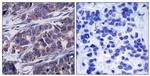 Phospho-DOK1 (Tyr362) Antibody in Immunohistochemistry (Paraffin) (IHC (P))