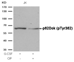 Phospho-DOK1 (Tyr362) Antibody in Western Blot (WB)