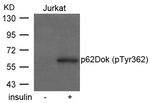 Phospho-DOK1 (Tyr362) Antibody in Western Blot (WB)