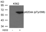 Phospho-DOK1 (Tyr398) Antibody in Western Blot (WB)