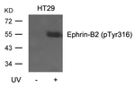 Phospho-Ephrin B2 (Tyr316) Polyclonal Antibody
