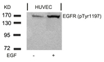 Phospho-EGFR (Tyr1197) Antibody in Western Blot (WB)