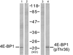 Phospho-4EBP1 (Thr37) Antibody in Western Blot (WB)