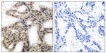Phospho-4EBP1 (Thr46) Polyclonal Antibody