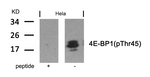 Phospho-4EBP1 (Thr46) Antibody in Western Blot (WB)