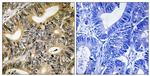 Phospho-4EBP1 (Thr70) Antibody in Immunohistochemistry (Paraffin) (IHC (P))