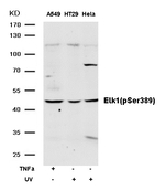 Phospho-ELK1 (Ser389) Antibody in Western Blot (WB)