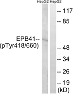 Phospho-EPB41 (Tyr418, Tyr660) Polyclonal Antibody