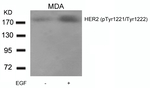 Phospho-ErbB2 (HER-2) (Tyr1221, Tyr1222) Antibody in Western Blot (WB)