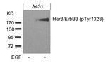 Phospho-ErbB3 (Tyr1328) Antibody in Western Blot (WB)