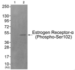 Phospho-Estrogen Receptor alpha (Ser102) Antibody in Western Blot (WB)
