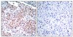 Phospho-Estrogen Receptor alpha (Ser104) Antibody in Immunohistochemistry (Paraffin) (IHC (P))