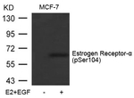 Phospho-Estrogen Receptor alpha (Ser104) Antibody in Western Blot (WB)