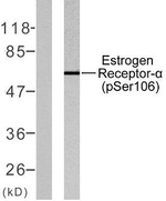 Phospho-Estrogen Receptor alpha (Ser106) Antibody in Western Blot (WB)