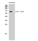 Phospho-Estrogen Receptor alpha (Ser106) Antibody in Western Blot (WB)