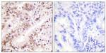 Phospho-Estrogen Receptor alpha (Tyr537) Antibody in Immunohistochemistry (Paraffin) (IHC (P))
