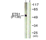 Phospho-ETS1 (Thr38) Antibody in Western Blot (WB)