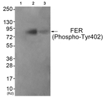 Phospho-FER (Tyr402) Antibody in Western Blot (WB)