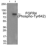 Phospho-FGFR4 (Tyr642) Antibody in Western Blot (WB)