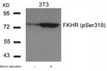 Phospho-FOXO1 (Ser319) Antibody in Western Blot (WB)