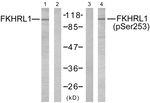 Phospho-FOXO3A (Ser253) Antibody in Western Blot (WB)
