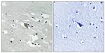 Phospho-VEGF Receptor 1 (Tyr1048) Antibody in Immunohistochemistry (Paraffin) (IHC (P))