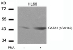 Phospho-GATA1 (Ser142) Antibody in Western Blot (WB)