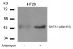 Phospho-GATA1 (Ser310) Antibody in Western Blot (WB)