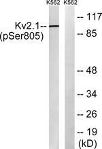 Phospho-KV2.1 (Ser805) Antibody in Western Blot (WB)