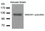 Phospho-NMDAR1 (Ser896) Polyclonal Antibody