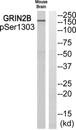 Phospho-NMDAR2B (Ser1303) Antibody in Western Blot (WB)