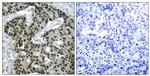 Phospho-HSF1 (Ser303) Antibody in Immunohistochemistry (Paraffin) (IHC (P))