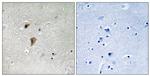 Phospho-HSF1 (Thr142) Antibody in Immunohistochemistry (Paraffin) (IHC (P))