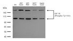 Phospho-IGF1R beta (Tyr1161) Antibody in Western Blot (WB)