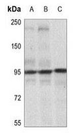 Phospho-IGF1R beta (Tyr1165, Tyr1166) Antibody in Western Blot (WB)