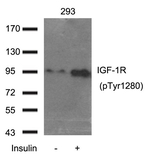 Phospho-IGF1R beta (Tyr1280) Polyclonal Antibody