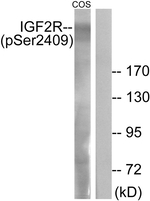 Phospho-IGF2R (Ser2409) Antibody in Western Blot (WB)