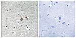 Phospho-IRAK1 (Ser376) Polyclonal Antibody