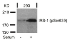 Phospho-IRS1 (Ser639) Antibody in Western Blot (WB)