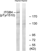 Phospho-CD104 (Tyr1510) Antibody in Western Blot (WB)