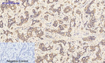 Phospho-JAK1 (Tyr1034) Antibody in Immunohistochemistry (Paraffin) (IHC (P))