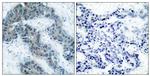 Phospho-JAK2 (Tyr1007) Polyclonal Antibody