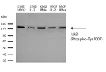 Phospho-JAK2 (Tyr1007) Antibody in Western Blot (WB)