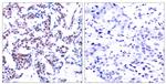 Phospho-JunB (Ser259) Antibody in Immunohistochemistry (Paraffin) (IHC (P))