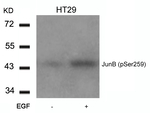 Phospho-JunB (Ser259) Antibody in Western Blot (WB)