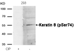 Phospho-Cytokeratin 8 (Ser74) Antibody in Western Blot (WB)
